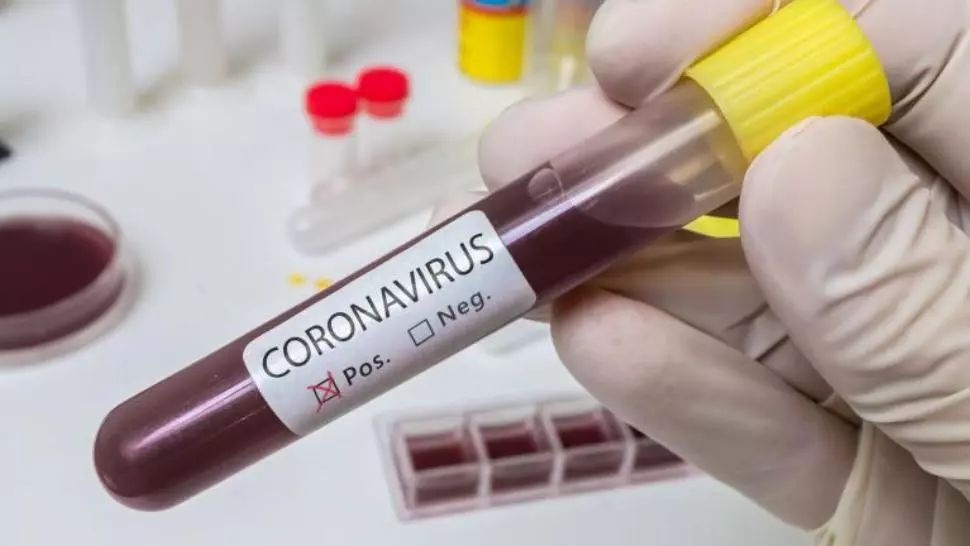 coronavirus