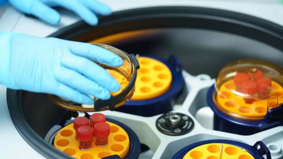 Andrei Dracea, escrocherie cu celule stem: sute de familii de români, înșelate de afaceristul "licitație la minut"