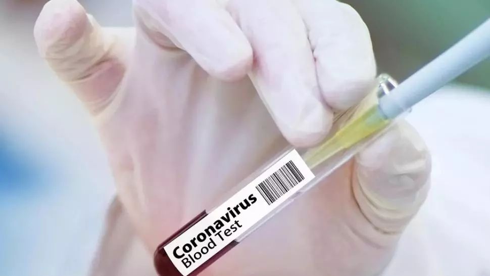Bilanț oficial: 1151 de decese cauzate de infecție cu coronavirus, în România