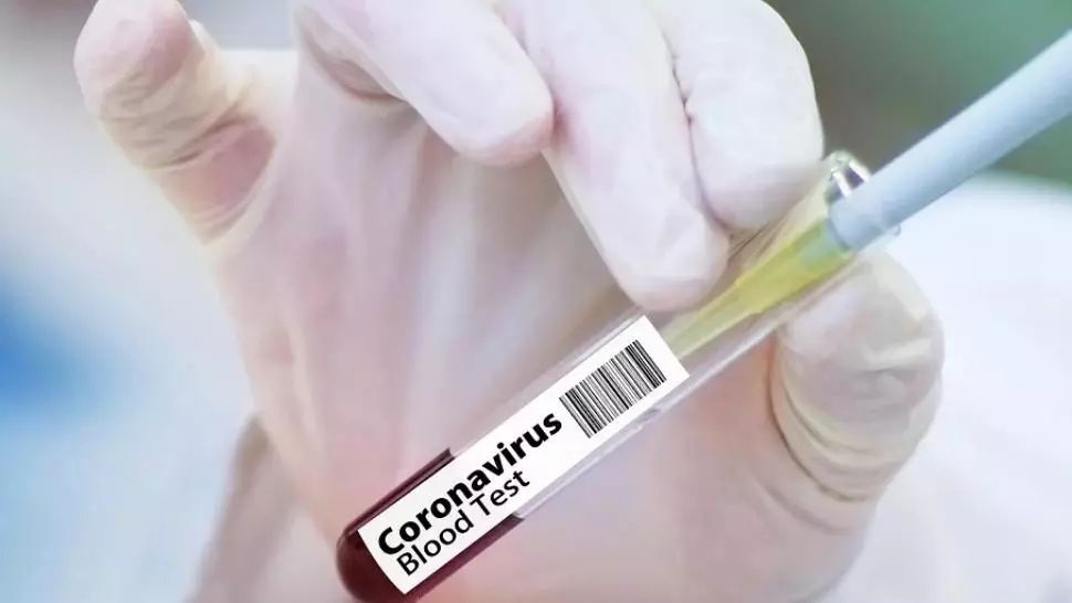 coronavirus Foto: Pixabay.com