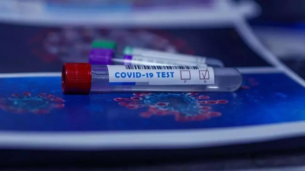 testare coronavirus Foto: Pixabay.com
