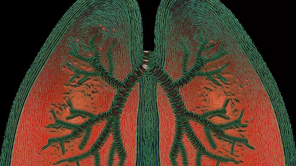 Consiliul Concurenței a amendat cu aproape 12 milioane de lei un producător de medicamente după ce a încetat să furnizeze Seretide, pentru astm bronșic Foto: Pixabay.com