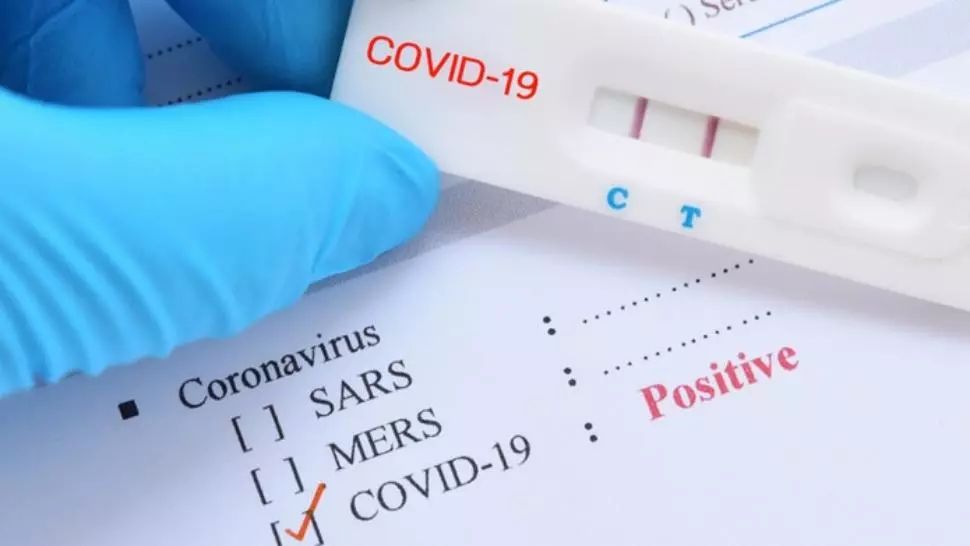 Testul antigen Covid-19 poate fi făcut acasă. Carmen Dorobăț explică procedura