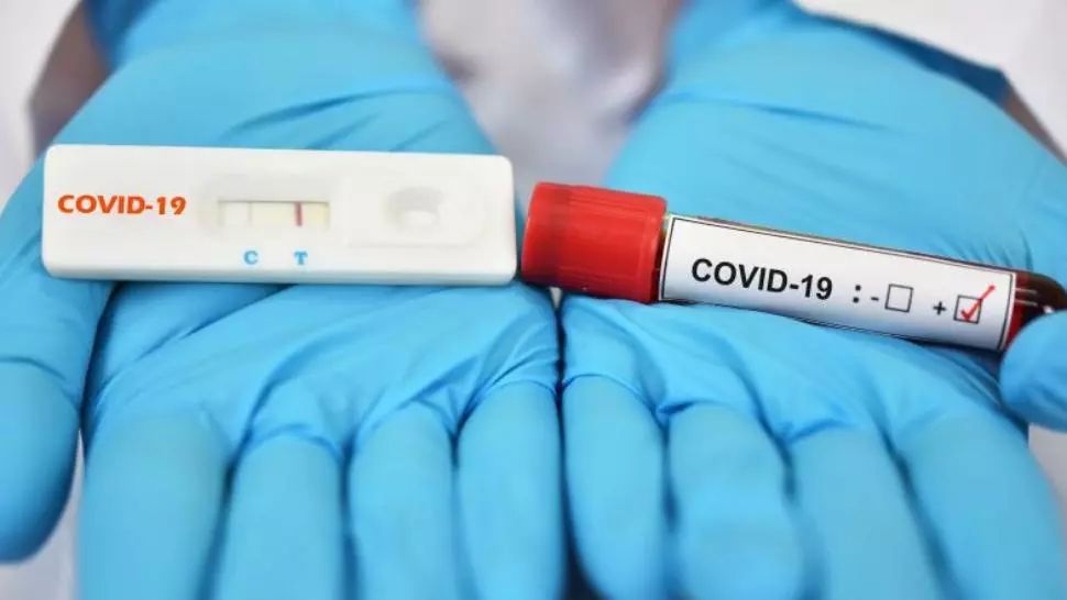 Teste rapide antigen și teste PCR pentru depistarea COVID