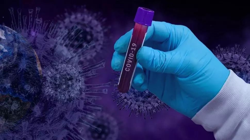 Infecție COVID-19