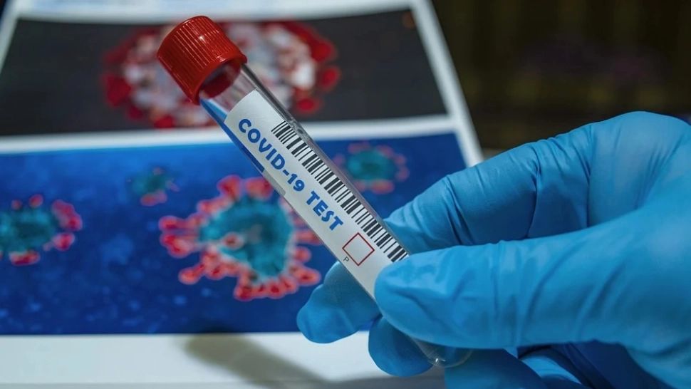 Infecție COVID-19