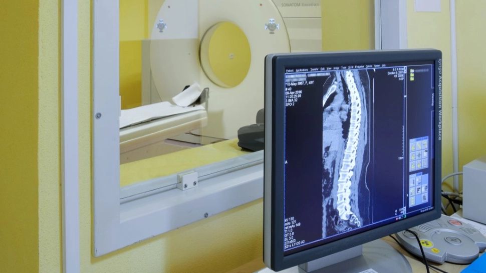 Tomografia a confirmat diagnosticul grav