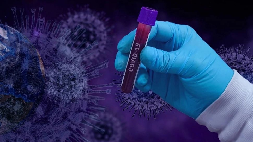 Infecție COVID-19