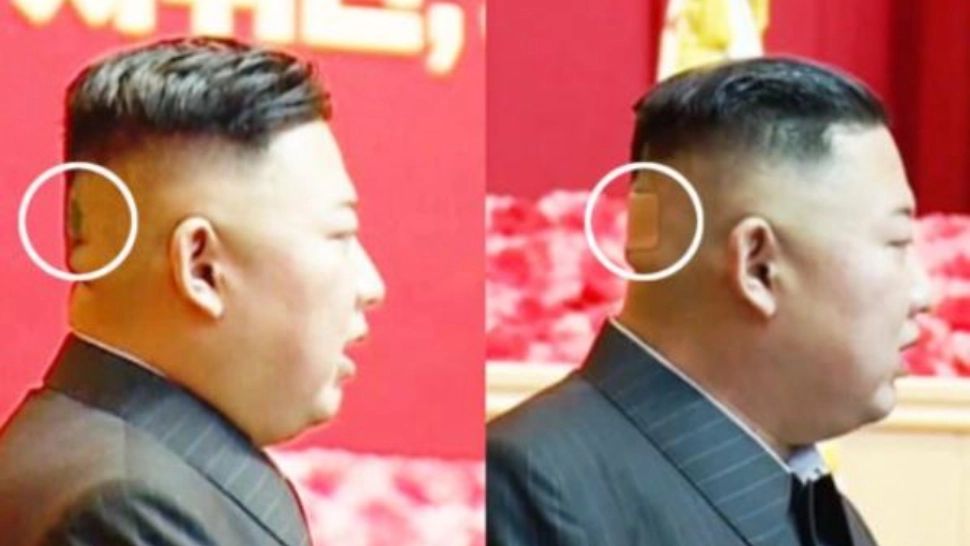 Kim Jong Un