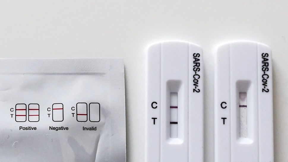 Test antigen rapid pentru depistarea infecției cu COVID-19 / Profimedia