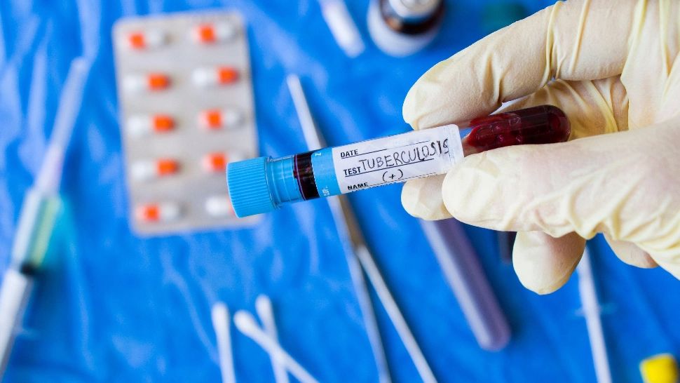 Tuberculoza se transmite printr-o simplă respirație. Foto/Profimedia