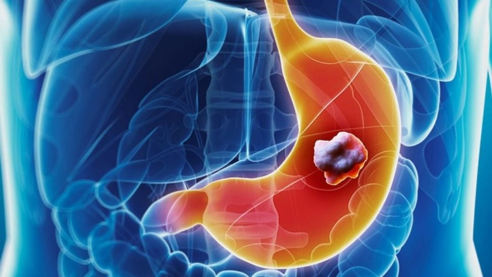 Cea mai puternică legumă: previne cancerul de colon, plămâni și stomac