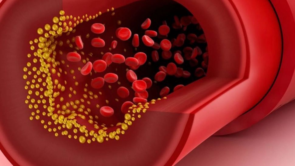 Cele 3 alimente care topesc depunerile de colesterol de pe vasele de sânge