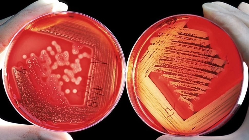 Virusul care provoacă infecţii la creier sau pneumonii fatale