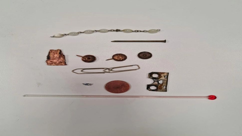 Obiecte găsite în stomacul unui pacient cu probleme psihice