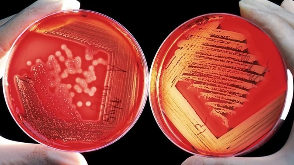 Varianta mortală a variolei maimuței a ajuns în Europa