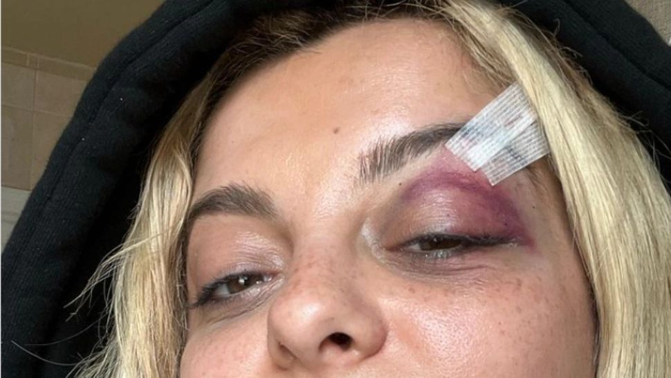Cântăreața Bebe Rexha, lovită în cap cu un telefon, în timpul concertului. S-a prăbușit pe scenă - VIDEO