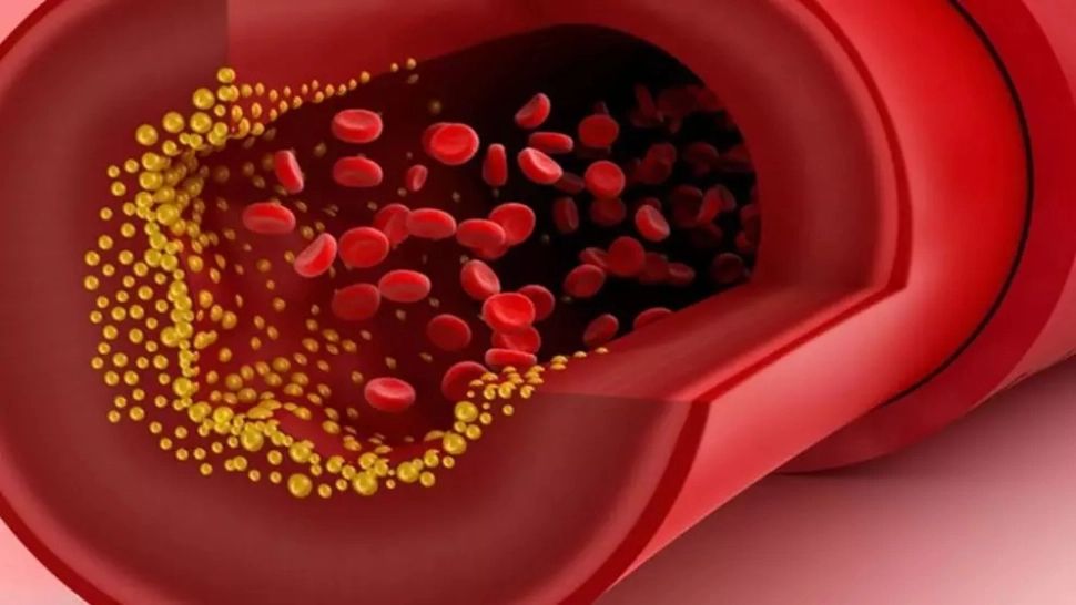 Persoanele care au problemel cu valorile colesterolului trebuie să fie precaute
