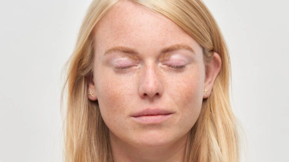 Acest semn de pe față, care apare mai ales în jurul ochilor, poate arăta probleme cu inima
