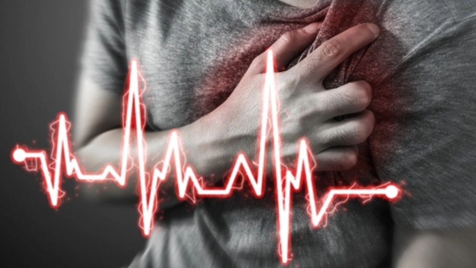 Infarct
