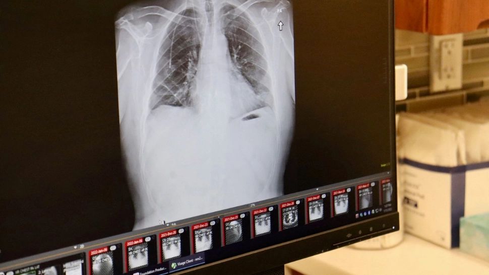 Un medic român dinamitează mitul pastilelor care CURĂȚĂ plămânii fumătorilor. N-ar trebui să existe pe piață