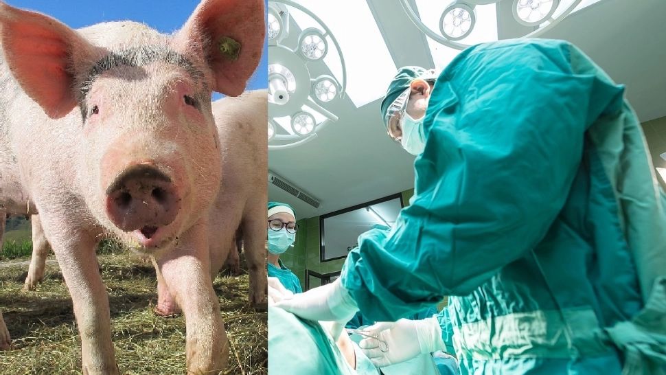 Un nou transplant al unui rinichi de porc la o pacientă americană. Foto: Profimedia