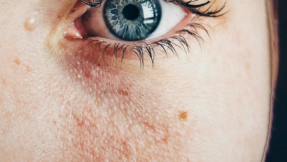 Remedii pentru pielea cu probleme și porii dilatați. Măști faciale preparate acasă, din ingrediente naturale