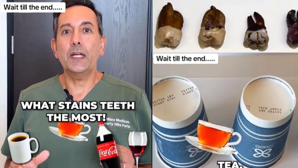 Experimentul unui dentist: Băutura care îți pătează mai mult dinții