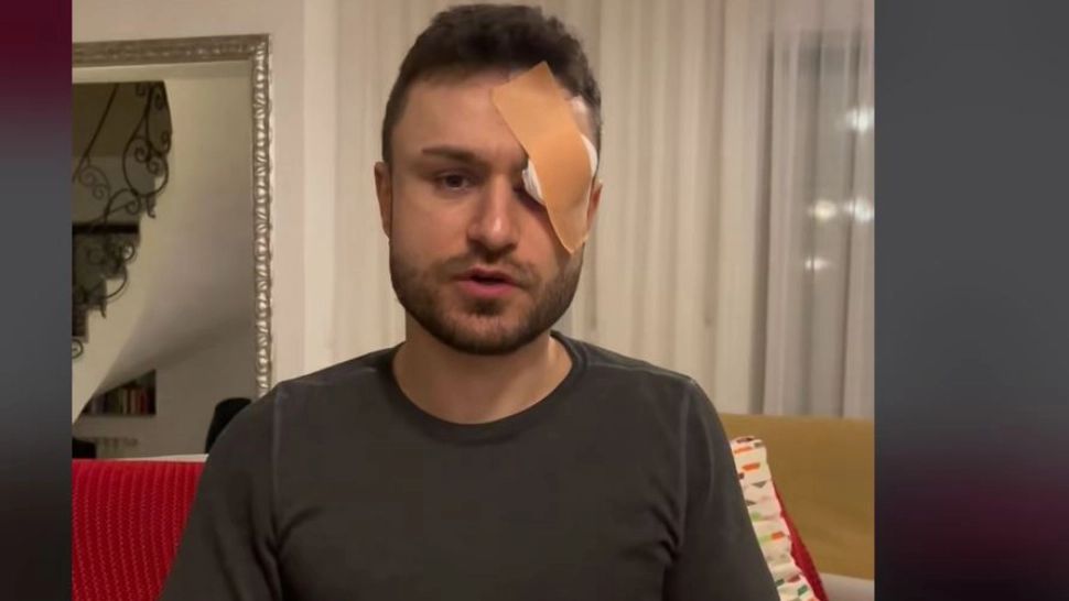 „Arman Abbasi” a postat un clip în care povestește că agresorul i-a dat „un pumn fix în ochi”. Foto/TikTok