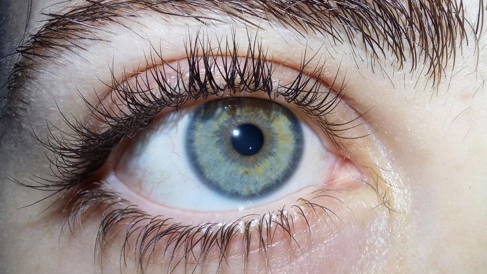 Ce înseamnă cercul gri din jurul irisului tău