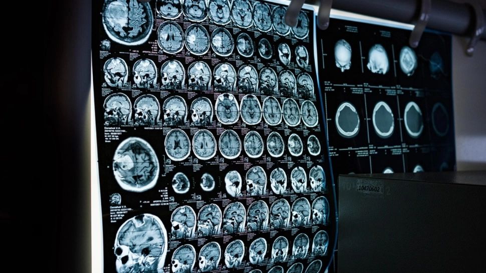 Ce este examenul PET-CT