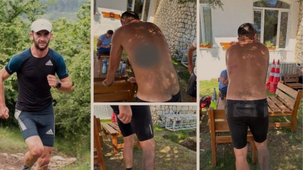 Antrenor de atletism, atacat de o haită de câini. Doar condiția fizică și intervenția unui localnic l-au salvat de la un deznodământ tragic - FOTO