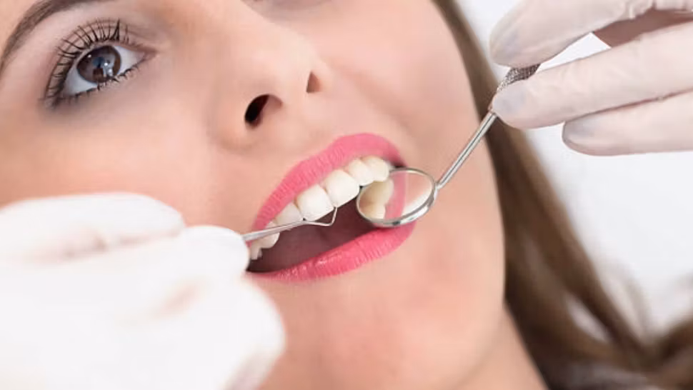 Medicul stomatolog recomandă efectuarea unui detartraj dentar o dată sau de două ori pe an, în funcție de nevoi