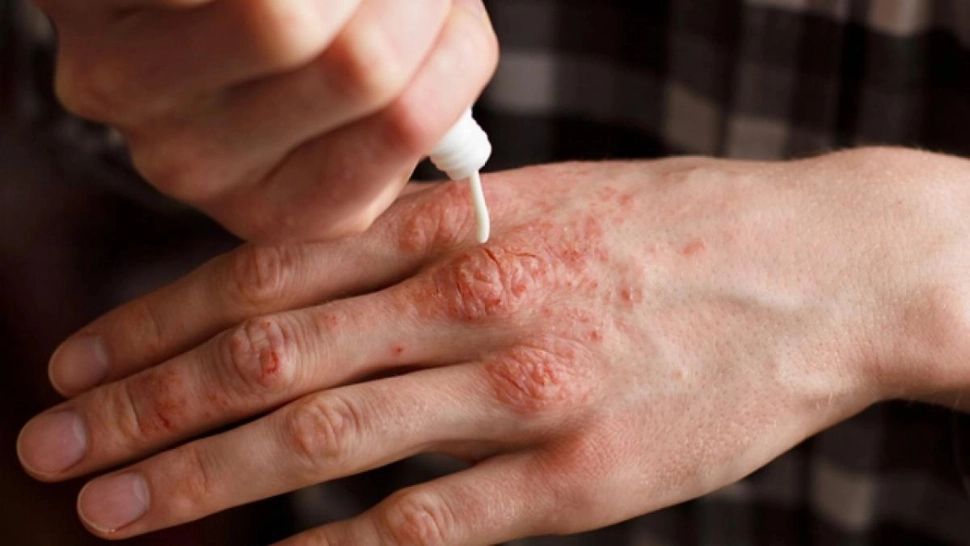 Alertă extinsă de lepră la un centrul SPA din Cluj: 2.000 de clienți rugați să meargă la medic (foto: arhivă)