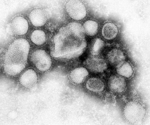 Canada a descifrat genomul virusului gripei porcine, un pas înainte spre un vaccin