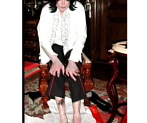 Fotografii şocante cu urmele lăsate de injecţii pe trupul lui Michael Jackson