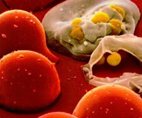Aproape o treime dintre seropozitivii din Uniunea Europeană ignoră infectarea cu HIV