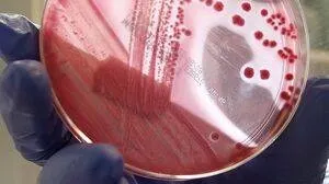 Cazul bebeluşilor infectaţi cu bacteria ucigaşă nu e singular. În Germania,criza a ucis 53 de oameni