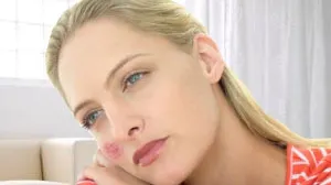Ai aceste simptome? Mergi de urgenţă la medic! Este LUPUS