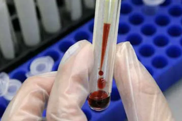 Ministerul Sănătății a suplimentat suma pentru programul HIV/SIDA