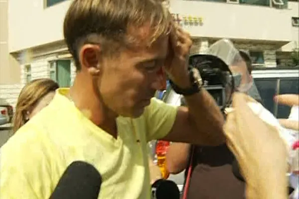RADU MAZĂRE, implicat într-un accident. Primarul, plin de sânge pe față