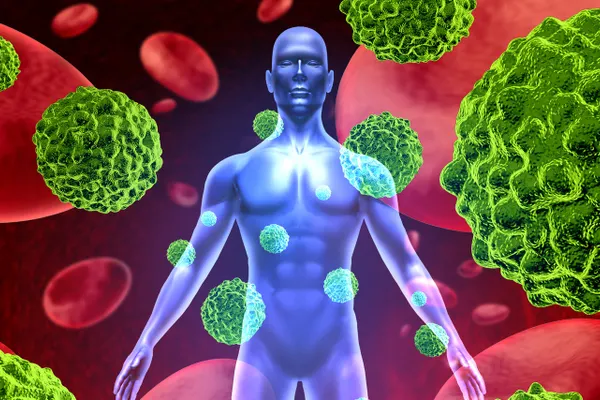Topul alimentelor care cauzează cancer. Vezi ce nu trebuie să mai consumi!