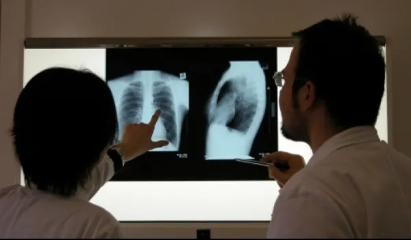 Alertă medicală. Focar de TBC, la o şcoală din Galaţi