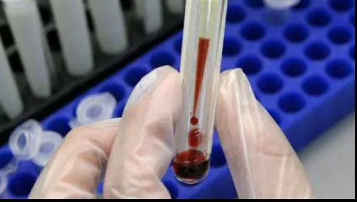 Testul culorilor care îţi arată ce probleme de sănătate ai