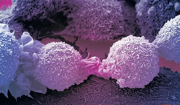 10 reguli de aur pentru prevenirea cancerului, spuse de un mare medic român