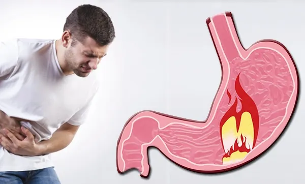 Dieta în gastrită: alimente permise și interzise