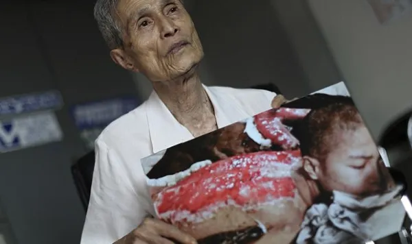 Imagini sfâșietoare. Cicatricile lăsate pe trupul unui bătrân de explozia de la Nagasaki