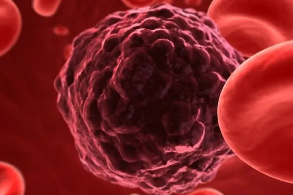 Principalele alimente care previn şi vindecă boli grave precum cancerul