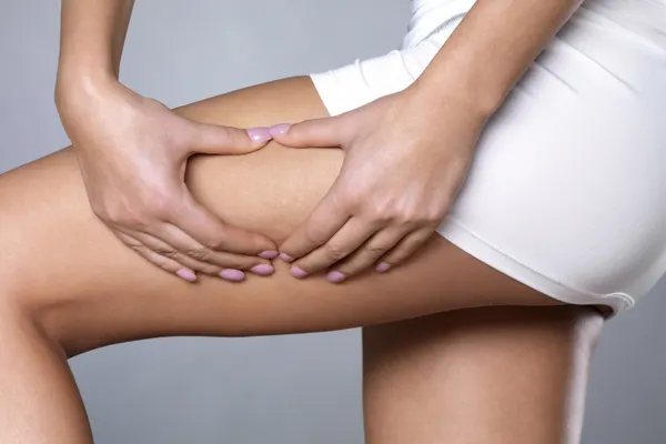 Alimente care provoacă celulita. Trebuie neapărat să renunţi la ele