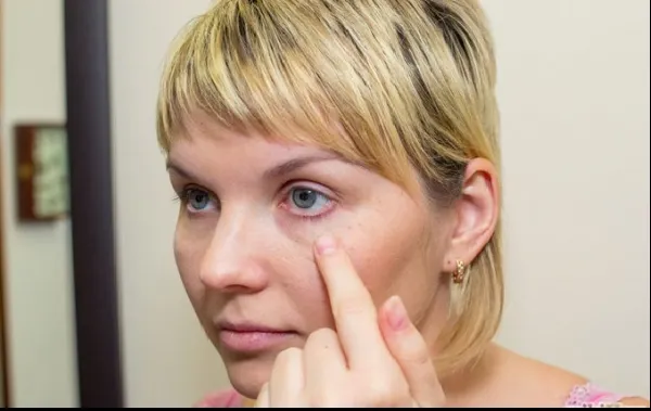 Ţi-au apărut pete pe faţă? Află ce probleme de sănătate pot ascunde acestea!